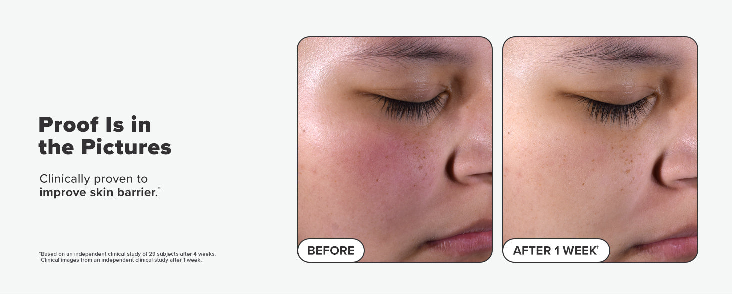 Paula's Choice SKIN PERFECTING 2% BHA Liquid Salicylic Acid Exfoliant-Facial Exfoliant for Blackheads, Enlarged Pores, Wrinkles & Fine Lines 24hrsmart